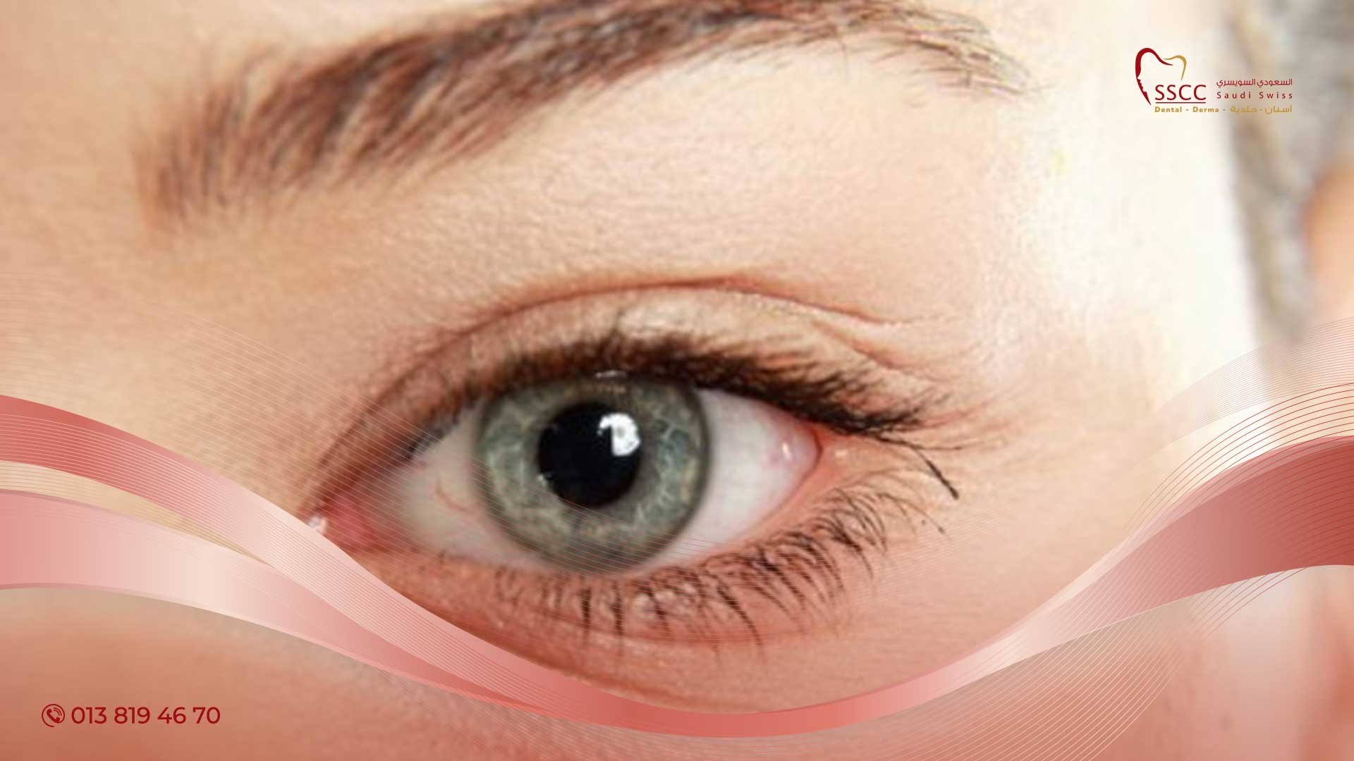 سرطان جفن العين
