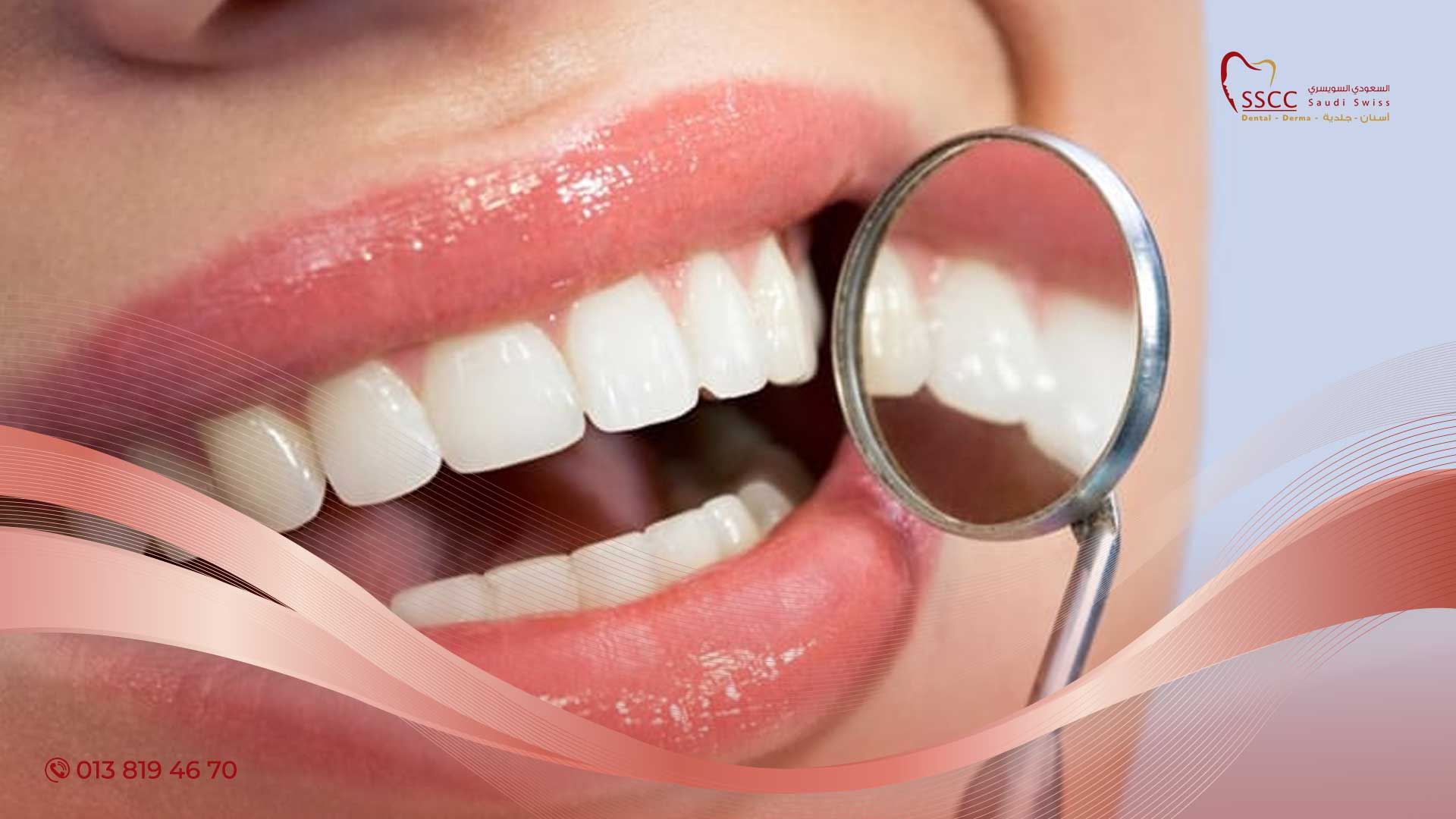 طقم-الاسنان