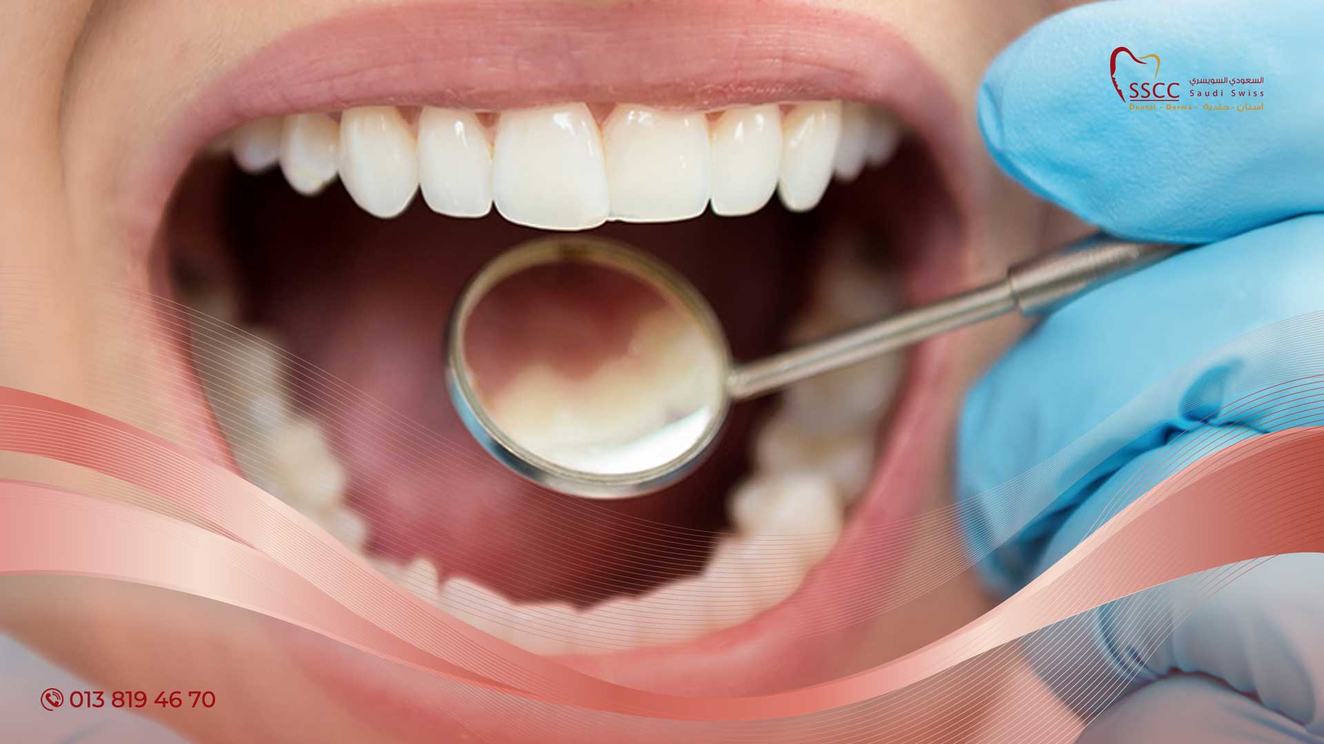 Можно вылечить зубы разом. Зубы с кариесом стоматология.