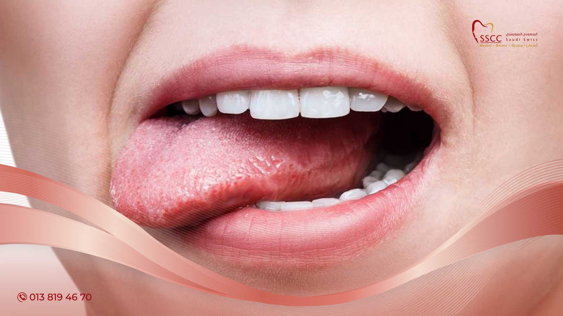 اعراض-سرطان-الفم