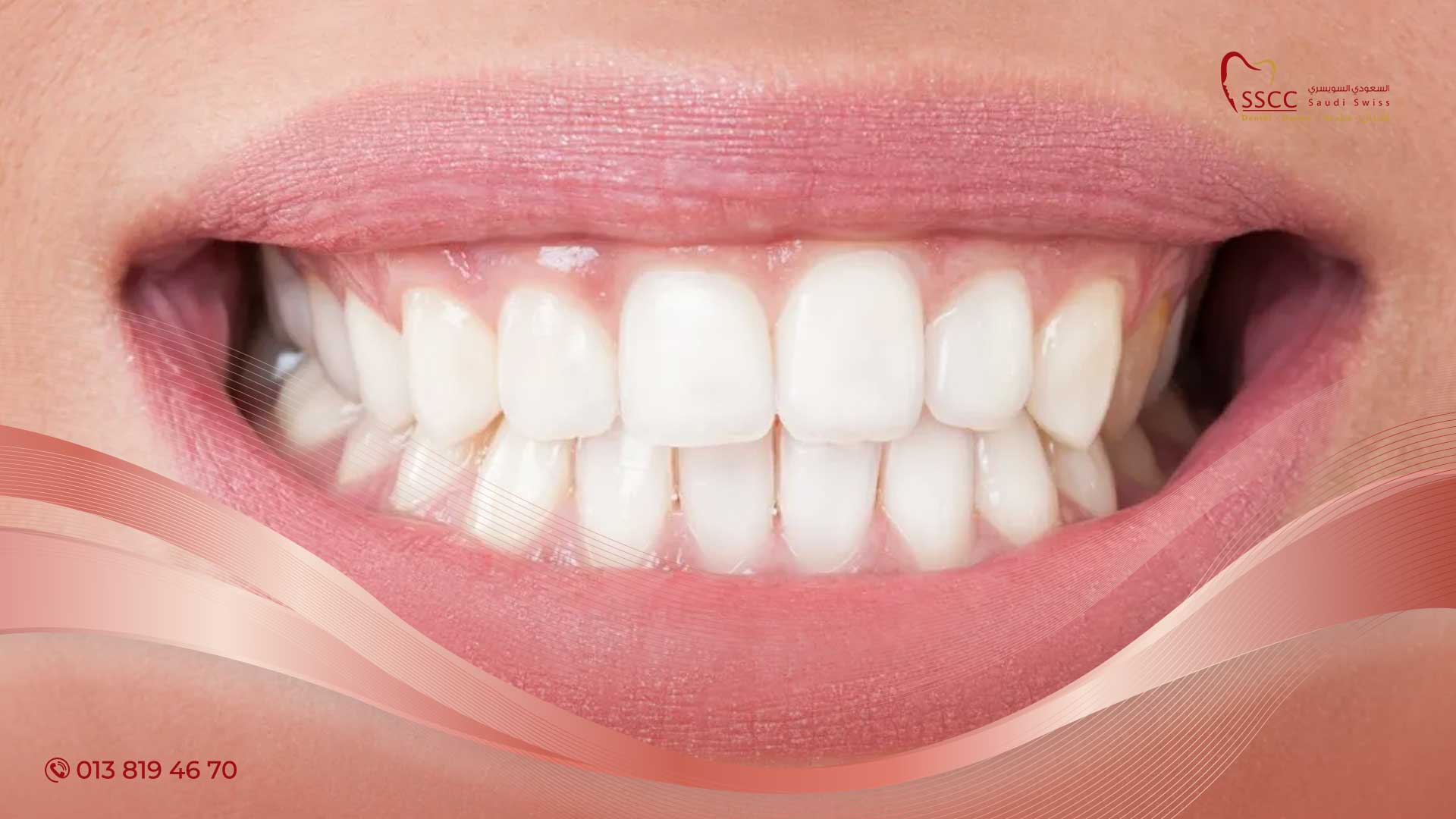 عدد الاسنان اللبنية