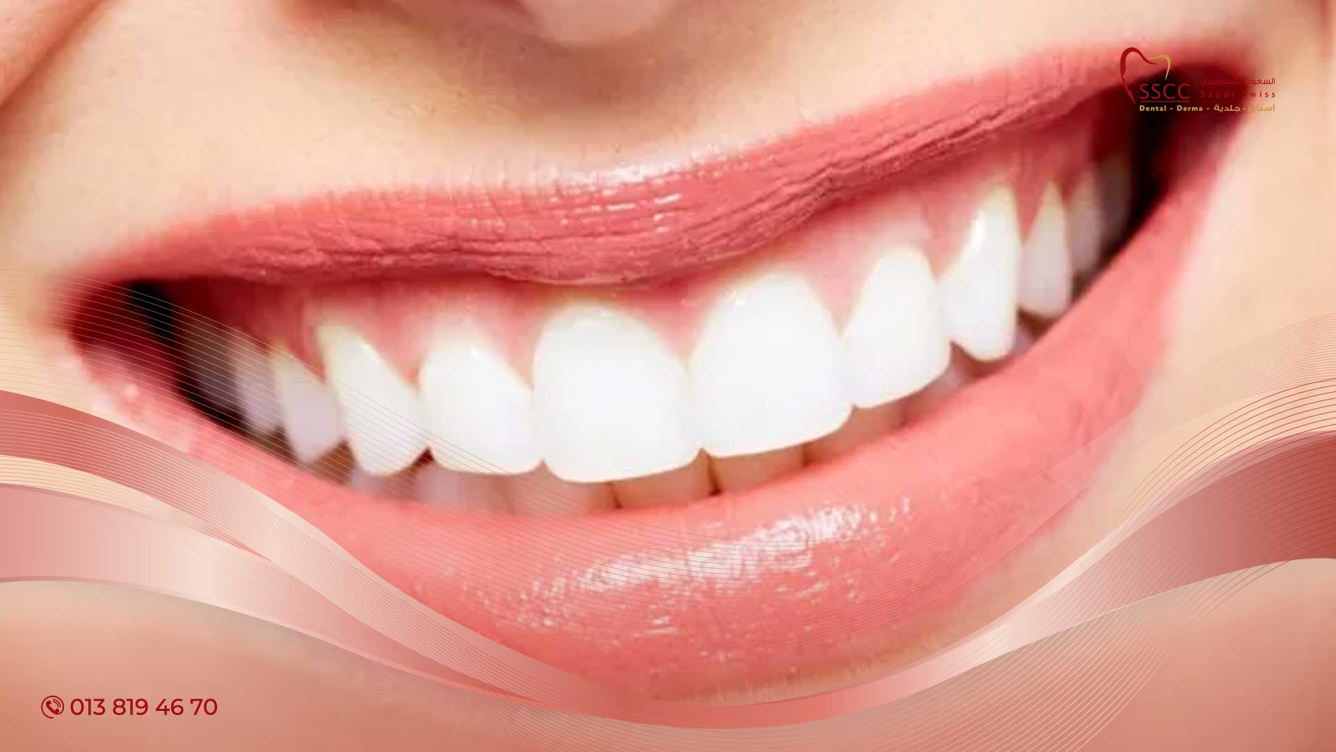 بيكربونات الصوديوم لتبييض الأسنان