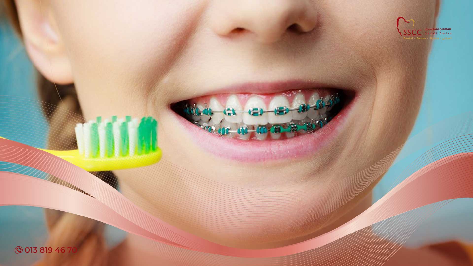 تقويم-الأسنان-المتحرك-للاطفال