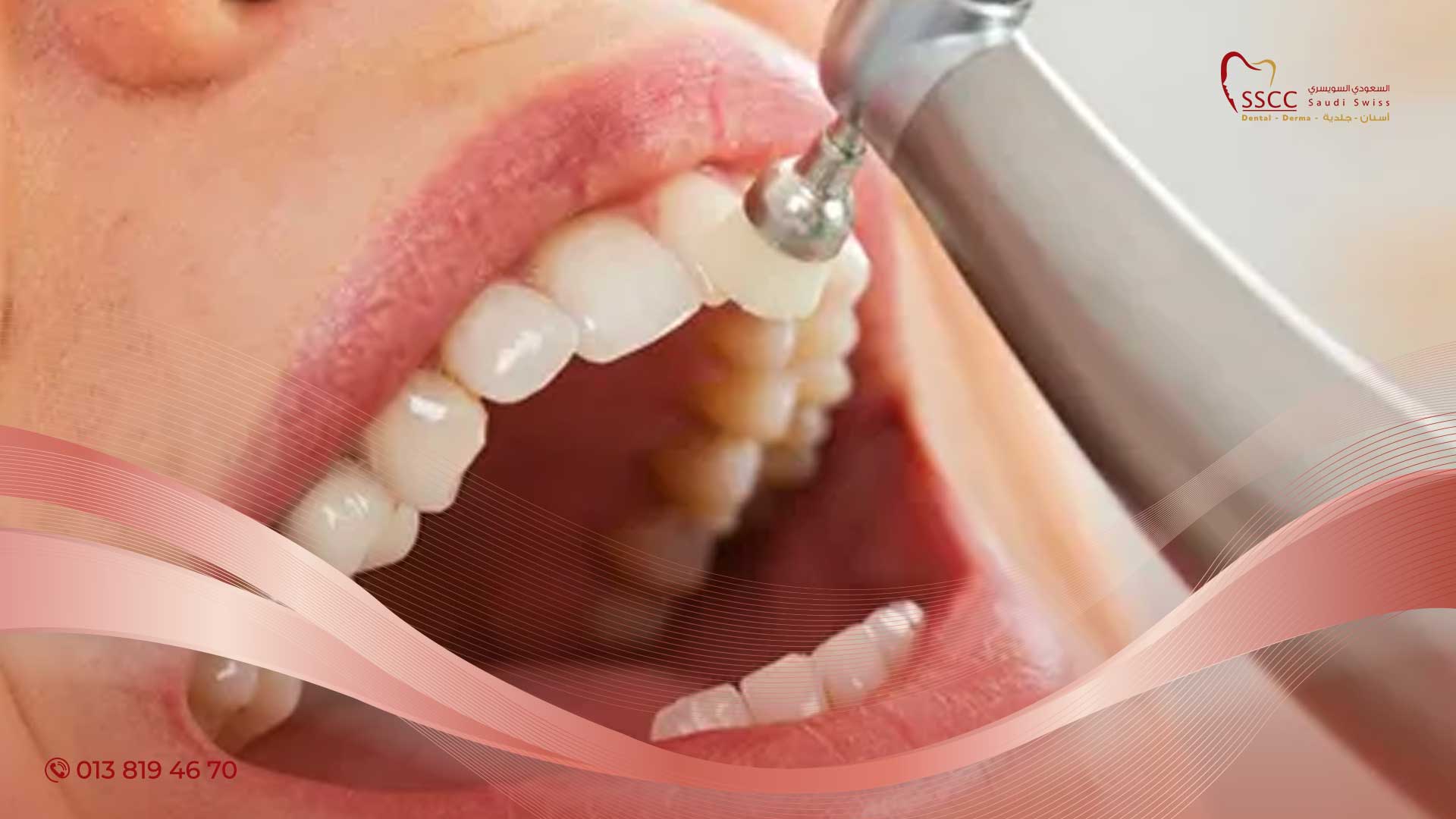 تنظيف-الأسنان-2