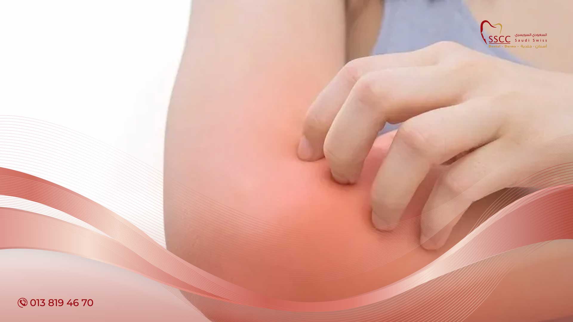 لماذا يظهر الطفح الجلدي
