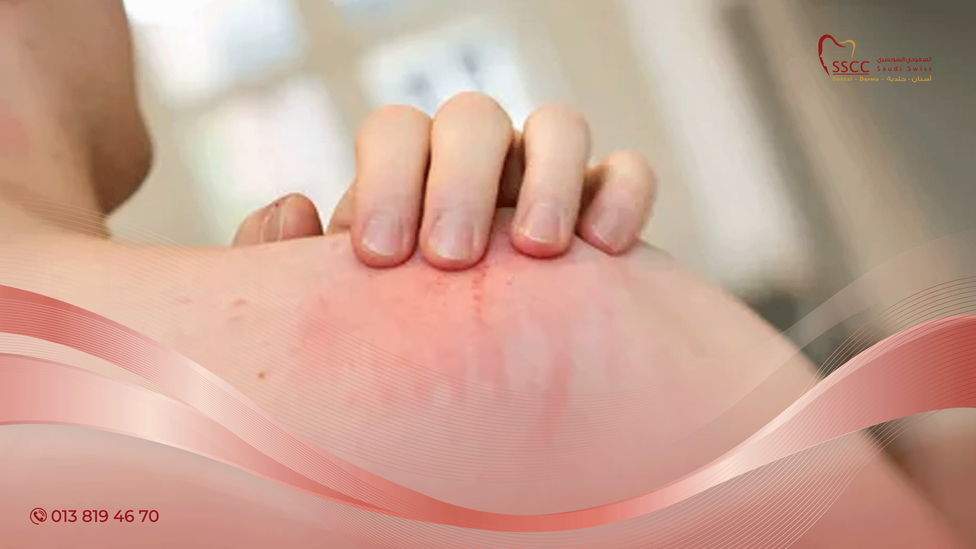 علاج التهاب الجلد البكتيري