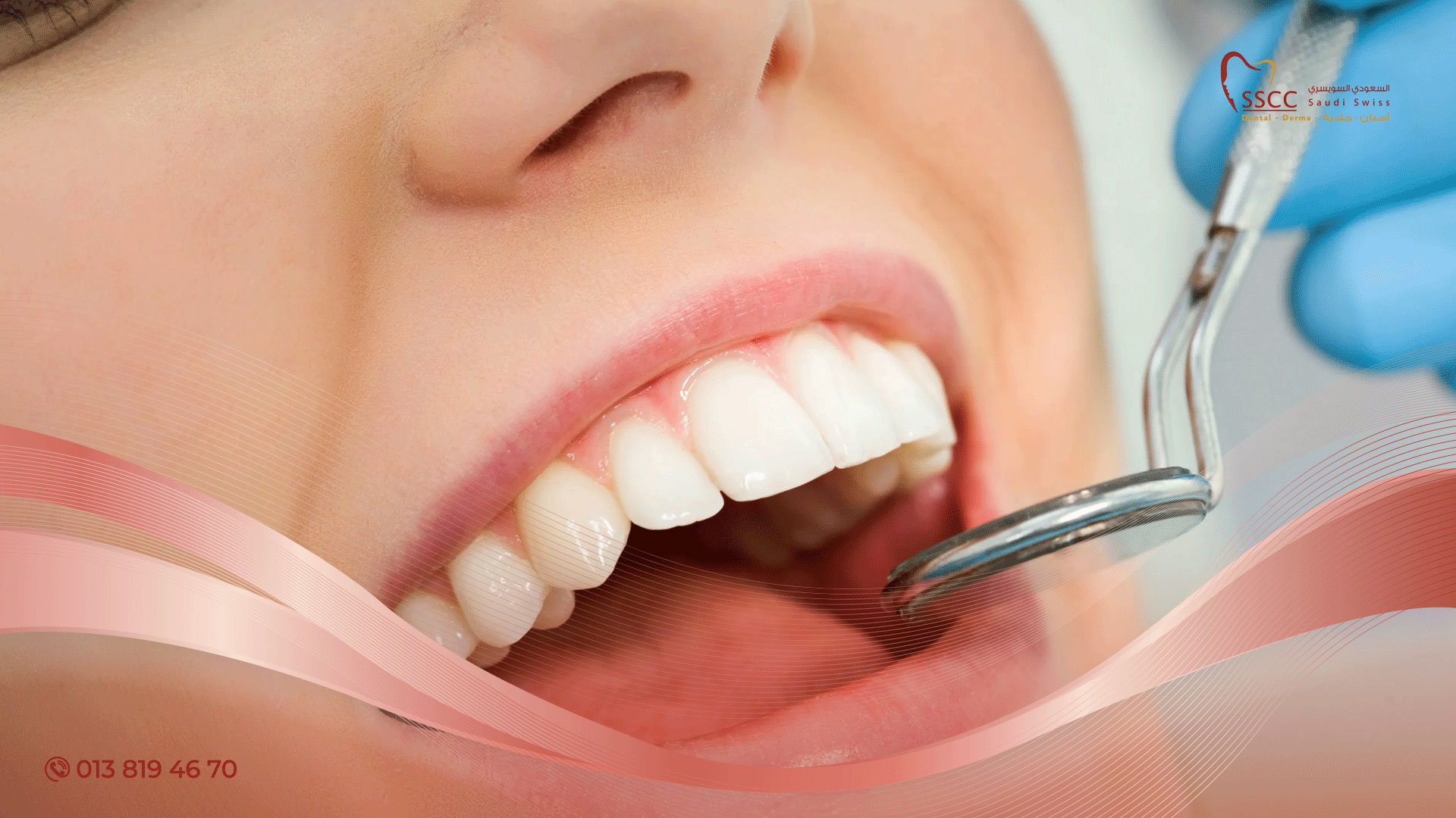 مراحل تركيب الأسنان