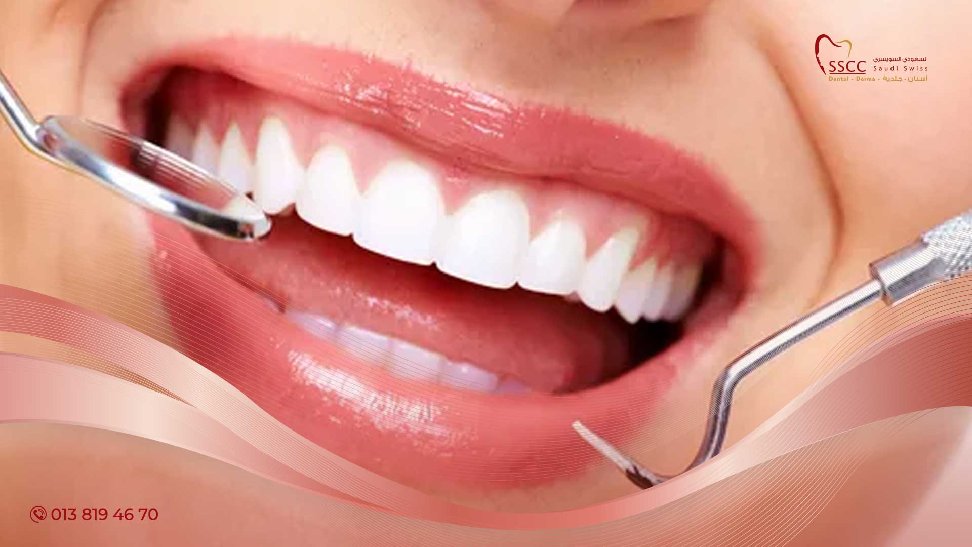 أحدث طرق علاج تشقق شرخ الأسنان الأمامية